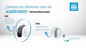 Retroauriculares