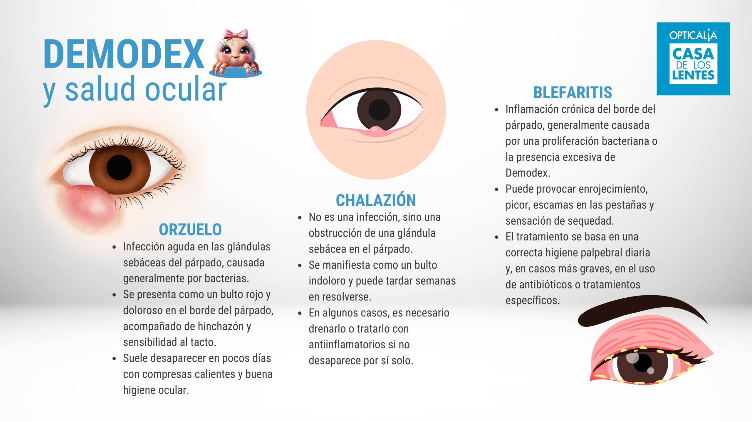 DEmodex